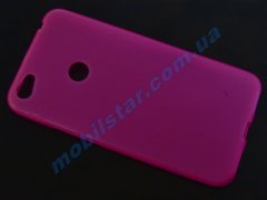 Чехол для Xiaomi Redmi Note5A, Xiaomi Redmi Y1 Lite розовый
