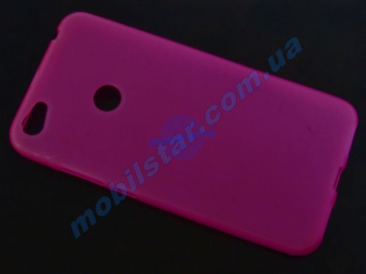 Чехол для Xiaomi Redmi Note5A, Xiaomi Redmi Y1 Lite розовый